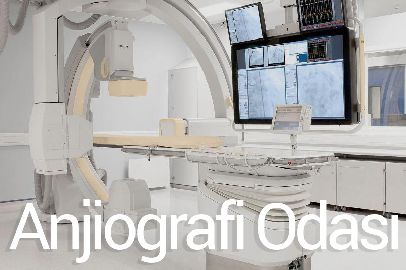 Anjiografi Odası